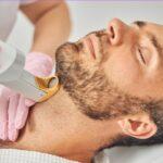 Depilación Láser Masculina Depilación Láser Masculina